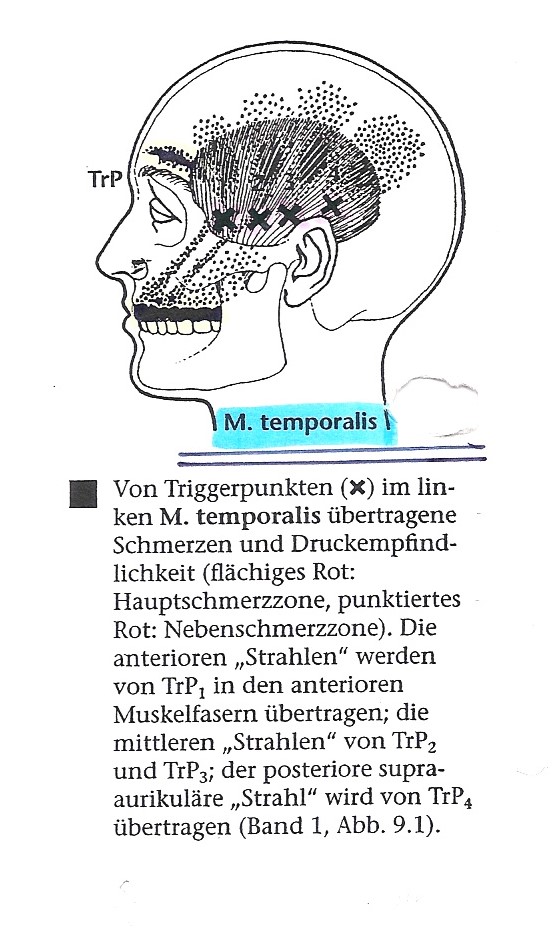 Kiefergelenk Triggerpoints Vorschau